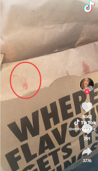 thumb