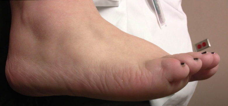 thumb