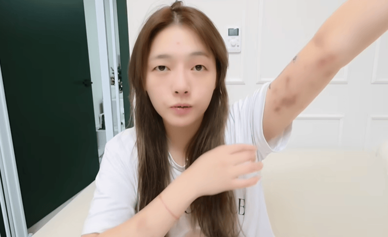 thumb