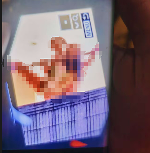 thumb