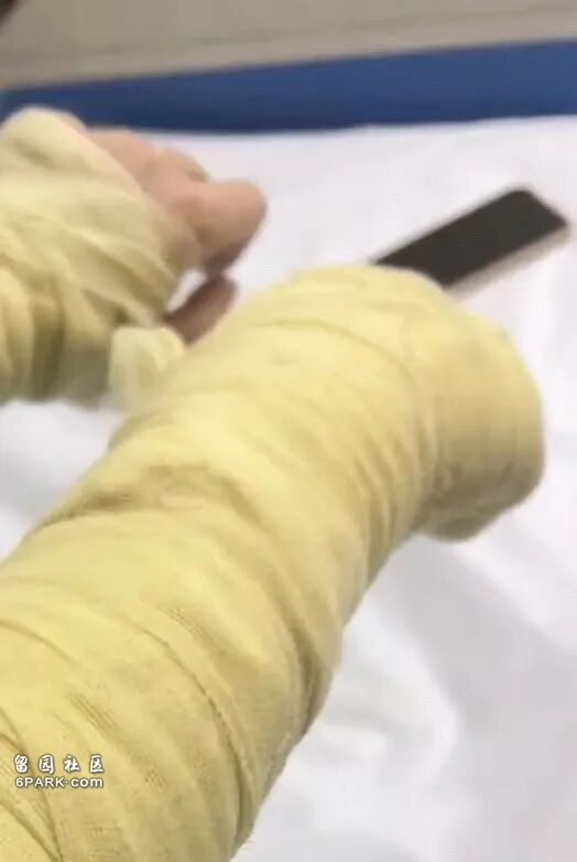 thumb