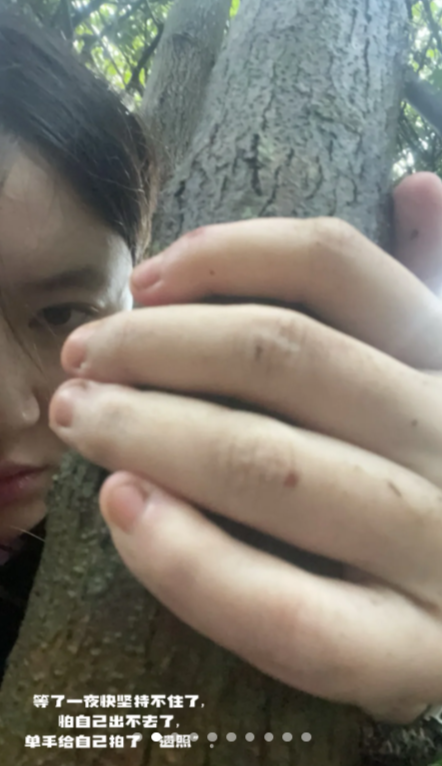 thumb