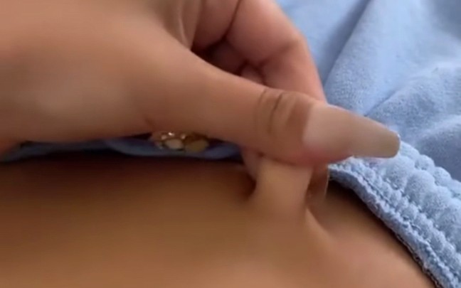 thumb